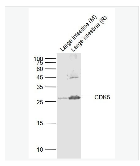 Anti-CDK5 antibody  -周期素依赖性激酶5抗体,CDK5