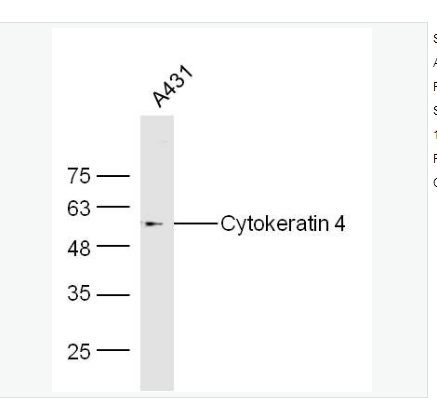 Anti-Cytokeratin 4   antibody  -細(xì)胞角蛋白4抗體,Cytokeratin 4