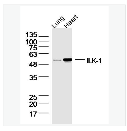 Anti-ILK-1 antibody  -整合素连接激酶-1抗体,ILK-1