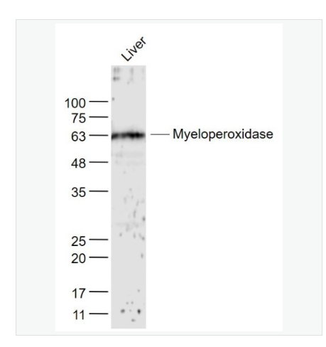 Anti-MPO antibody  -髓過氧化物酶抗體,MPO