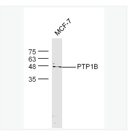 Anti-PTPN1 antibody  -蛋白酪氨酸磷酸酶-1B抗體,PTPN1