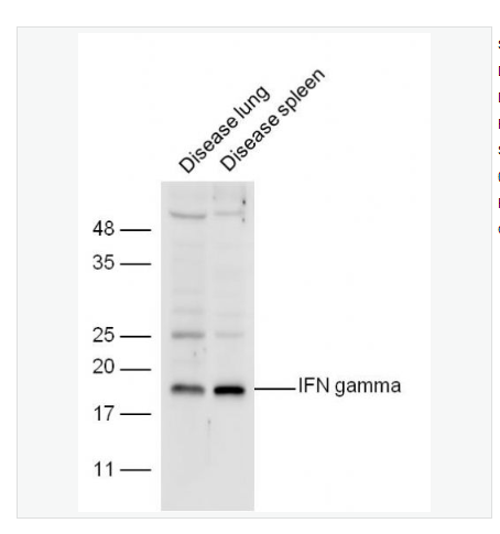 Anti-IFN gamma antibody  -干扰素-γ/IFN-γ抗体,IFN gamma
