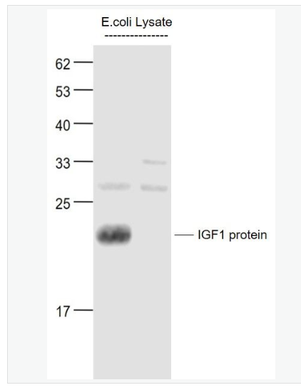 Anti-IGF 1antibody  -胰岛素样生长因子1抗体,IGF 1