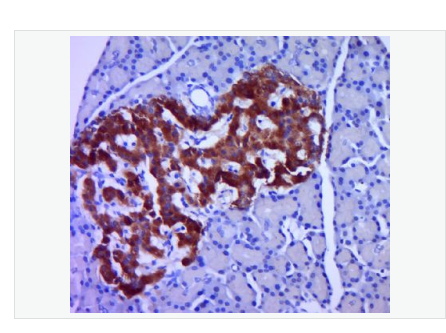 Anti-Proinsulin antibody  -胰岛素原抗体,Proinsulin