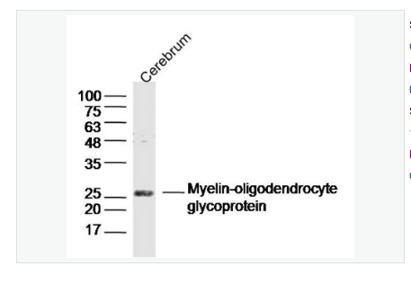 Anti-MOG antibody  -髓鞘少树突胶质细胞糖蛋白抗体,MOG