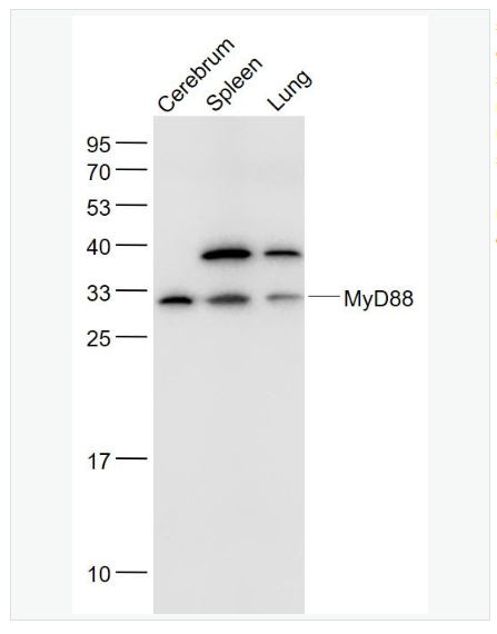 Anti-MyD88 antibody  -髓样分化蛋白抗体,MyD88