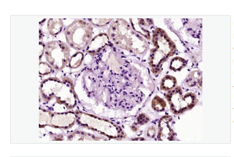 Anti-Nestin antibody  -巢蛋白/神经上皮干细胞蛋白抗体,Nestin