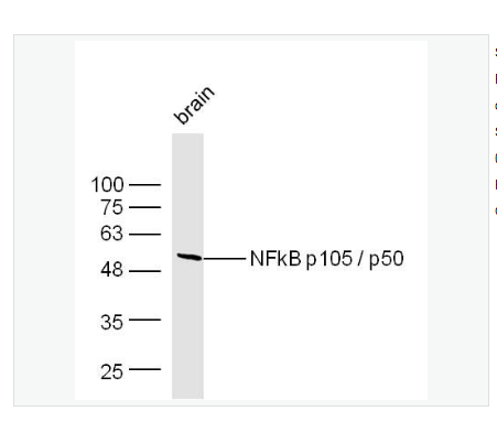 Anti-NFKB1antibody  -细胞核因子p50/k基因结合核因子抗体,NFKB1