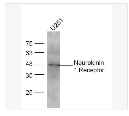 Anti-Neurokinin 1 Receptorantibody  -P物质受体抗体,Neurokinin 1 Receptor