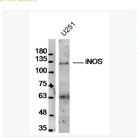 Anti-iNOS antibody  -一氧化氮合成酶-2（誘導(dǎo)型）抗體,iNOS