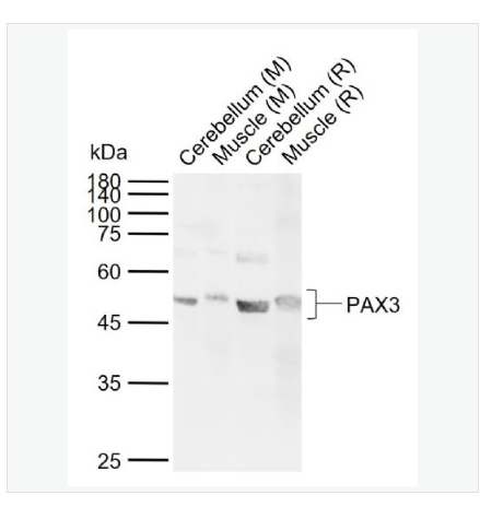 Anti-PAX3  antibody  -配对盒基因3抗体,PAX3