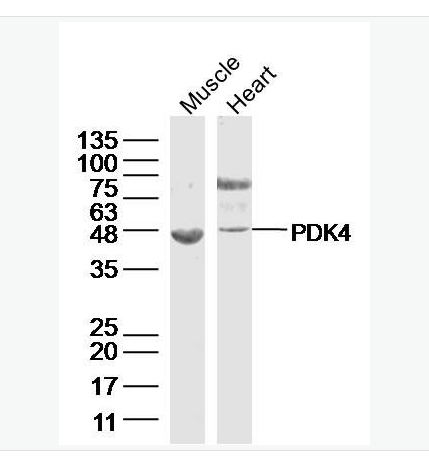 Anti-PDK4 antibody  -丙酮酸脫氫酶激酶4抗體,PDK4