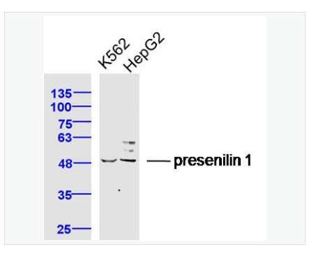 Anti-presenilin 1antibody  -早老素蛋白-1抗体,presenilin 1