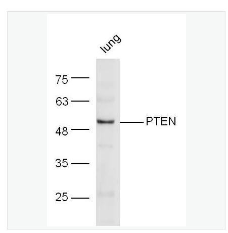 Anti-PTEN antibody  -磷酸酶和张力蛋白同系物抗体,PTEN