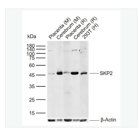 Anti-SKP2 antibody  -细胞S期激酶相关蛋白2抗体,SKP2