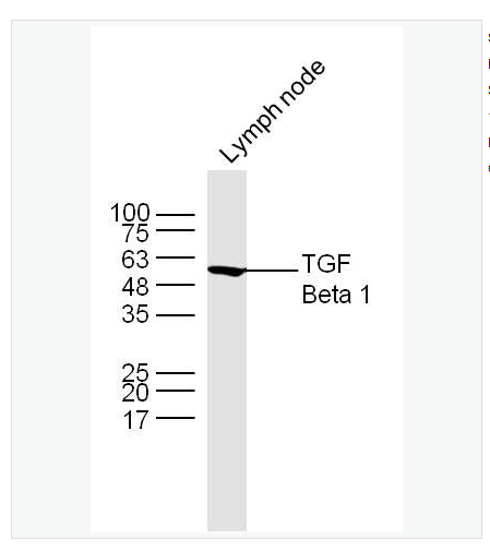 Anti-TGF Beta 1 antibody  -轉(zhuǎn)化生長(zhǎng)因子β1抗體,TGF Beta 1