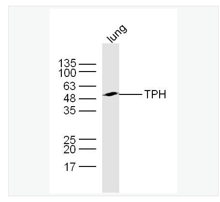 Anti-TPH antibody  -色氨酸羟化酶抗体,TPH