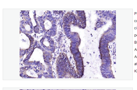 Anti-Galectin 9  antibody  -半乳糖凝集素9抗体,Galectin 9