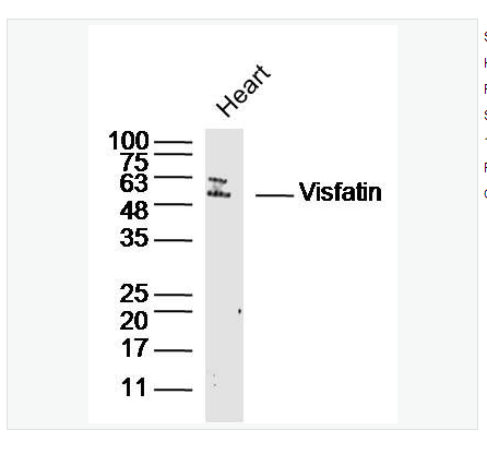 Anti-Visfatin antibody  -内脂素/内脏脂肪素/前B细胞克隆增强因子1抗体,Visfatin