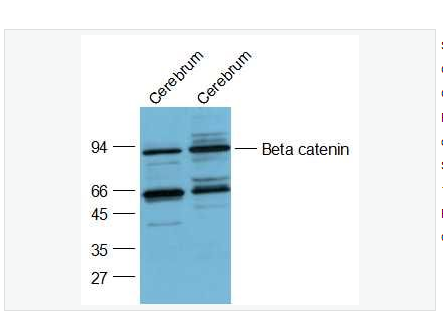 Anti-Beta catenin antibody  -β-连环蛋白/β-连环素/β链接素抗体,Beta catenin