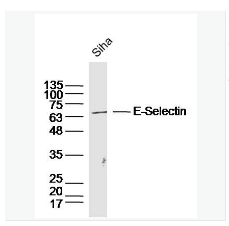 Anti-E-Selectin antibody  -E選擇素抗體,E-Selectin