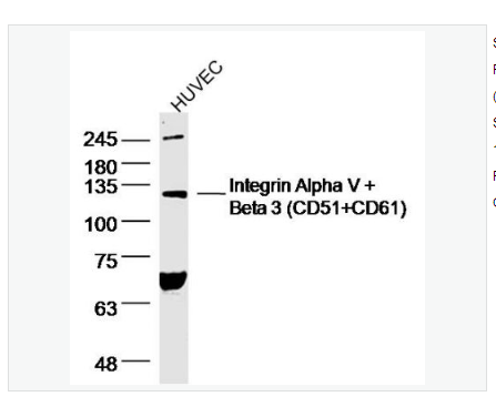 Anti-Integrin Alpha V + Beta 3 antibody  -整合素αVβ3抗体,Integrin Alpha V + Beta 3 (CD51+CD61)