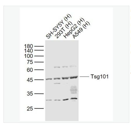 Anti-TSG101 antibody  -肿瘤易感基因101蛋白抗体,TSG101