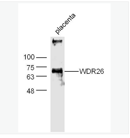 Anti-WDR26  antibody  -心肌缺血預(yù)處理正調(diào)節(jié)蛋白2抗體,WDR26