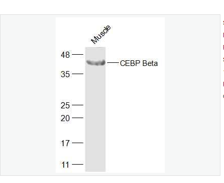 Anti-CEBP Beta  antibody  -转录调节因子C/EBP β抗体,CEBP Beta