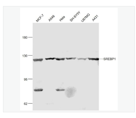 Anti-SREBP1  antibody  -胆固醇调节元件结合蛋白1抗体,SREBP1