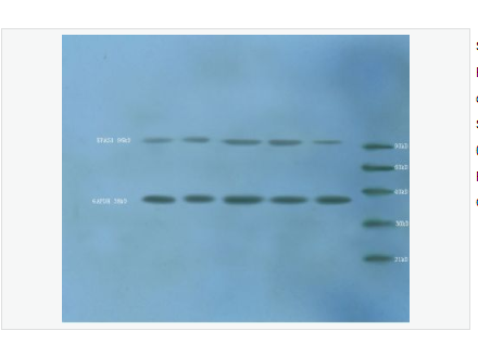 Anti-HIF 2 alpha  antibody  -缺氧诱导因子2α /EPAS1抗体,HIF 2 alpha