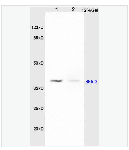 Anti-PAFR/PAF Receptor antibody  -血小板活化因子受體抗體,PAFR/PAF Receptor