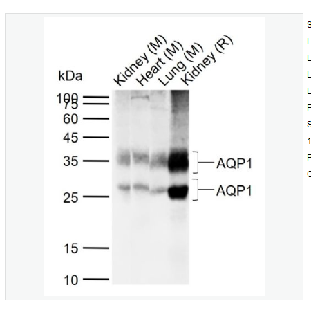 Anti-AQP1 antibody  -水通道蛋白1抗體,AQP1