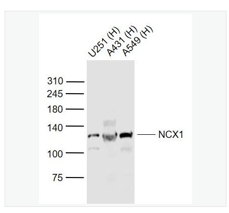 Anti-NCX1 antibody  -钠钙交换蛋白1抗体,NCX1
