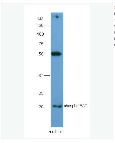 Anti-phospho-BAD antibody  -磷酸化相关死亡促进因子抗体,phospho-BAD (Ser128)