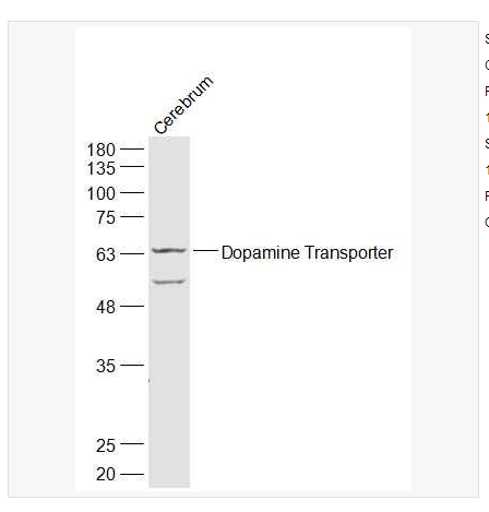 Anti-Dopamine Transporter antibody  -多巴胺转运蛋白DAT抗体,Dopamine Transporter