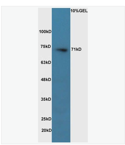 Anti-Pro-neuregulin-1 antibody  -神经胶质生长因子/神经调节蛋白β抗体,Pro-neuregulin-1, membrane-bound isoform