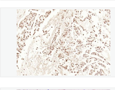 Anti-HDAC3 antibody  -组蛋白去乙酰化酶3抗体,HDAC3