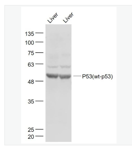 Anti-P53(wt-p53) antibody  -野生型P53肿瘤抑制基因抗体,P53(wt-p53)