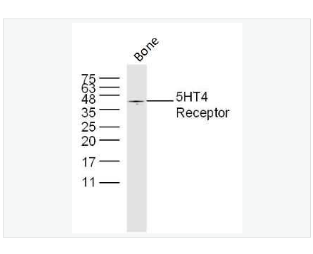 Anti-5HT4 Receptor antibody  -5-羟色胺受体4抗体,5HT4 Receptor