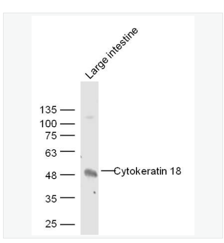Anti-CK18 antibody  -细胞角蛋白18抗体,CK18