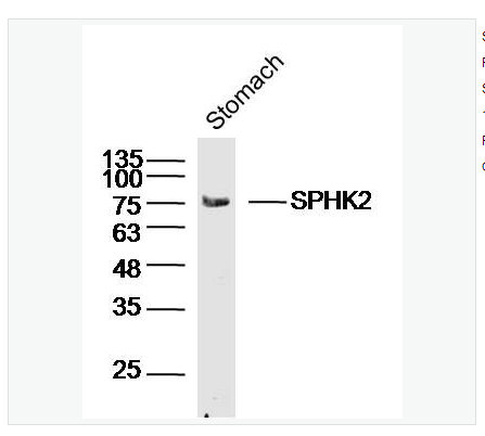Anti-SPHK2 antibody  -鞘氨醇激酶2抗体,SPHK2