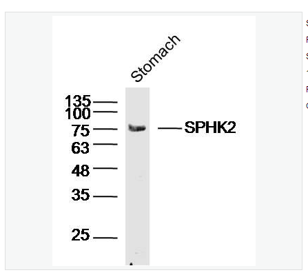 Anti-SPHK2 antibody  -鞘氨醇激酶2抗體,SPHK2