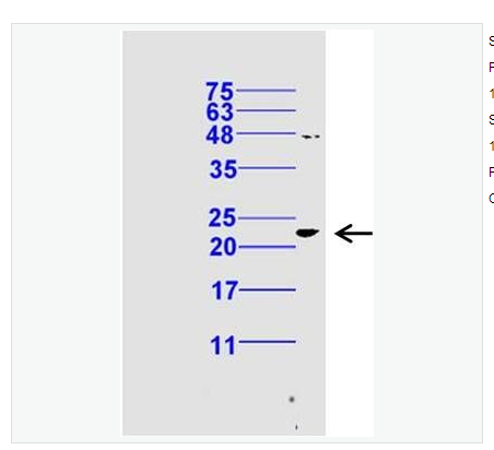 Anti-phospho-Bax antibody  -磷酸化Bax抗體,phospho-Bax (Ser184)