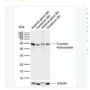 Anti-Tyrosine Hydroxylase antibody  -酪氨酸羟化酶兔单克隆抗体,Tyrosine Hydroxylase