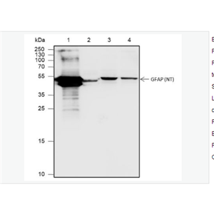 Anti-GFAP antibody  -胶质纤维酸性蛋白重组兔单克隆抗体