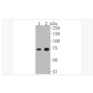 Anti-TAK1/MAP3K7  antibody  -转化生长因子β活化激酶1抗体