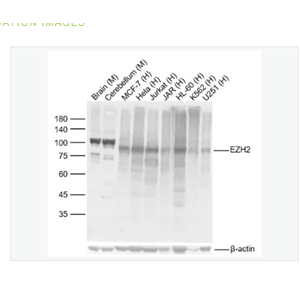 Anti-EZH2  antibody  -抑癌蛋白EZH2重组兔单克隆抗体