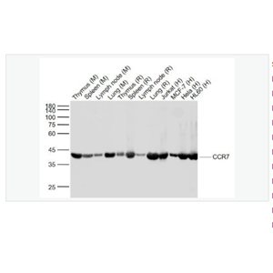 Anti-CCR7  antibody  -细胞表面趋化因子受体7重组兔单克隆抗体