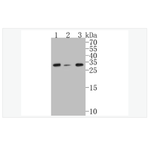 Anti-CHMP2B antibody  -染色质修饰蛋白2B重组兔单克隆抗体